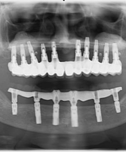 Aguas Vivas C.B. radiografía dental 